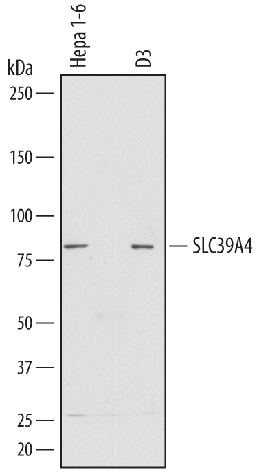Detection of Mouse SLC39A4 by Western Blot. Western blot shows lysates of Hepa 1-6 mouse hepatoma cell line and D3 mouse embryonic stem cell line. PVDF membrane was probed with 1 µg/mL of Goat Anti-Mouse SLC39A4 Antigen Affinity-purified Polyclonal Antibody (Catalog # AF7315) followed by HRP-conjugated Anti-Goat IgG Secondary Antibody (Catalog # HAF017 ). A specific band was detected for SLC39A4 at approximately 80 kDa (as indicated). This experiment was conducted under reducing conditions and using Immunoblot Buffer Group 1 .