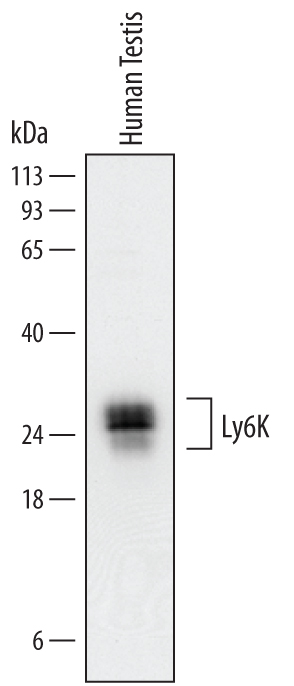 Detection of Human Ly6K by Western Blot. Western blot shows lysates of human testis tissue. PVDF Membrane was probed with 0.25 µg/mL of Sheep Anti-Human Ly6K Antigen Affinity-purified Polyclonal Antibody (Catalog # AF6648) followed by HRP-conjugated Anti-Sheep IgG Secondary Antibody (Catalog # HAF016 ). Specific bands were detected for Ly6K at approximately 25-27 kDa (as indicated). This experiment was conducted under reducing conditions and using Immunoblot Buffer Group 1 .