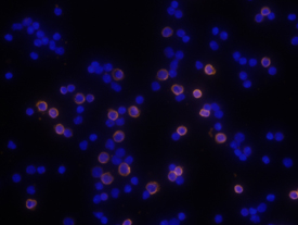 CD8 alpha in Mouse Splenocytes. CD8 alpha was detected in immersion fixed mouse splenocytes using 10 µg/mL Rat Anti-Mouse CD8 alpha Monoclonal Antibody (Catalog # MAB116) for 3 hours at room temperature. Cells were stained with the NorthernLights™ 557-conjugated Anti‑Rat IgG Secondary Antibody (red; Catalog # NL013) and counterstained with DAPI (blue). View our protocol for Fluorescent ICC Staining of Non-adherent Cells.