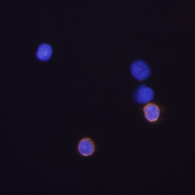 CD8 alpha in Mouse Splenocytes. CD8 alpha was detected in mouse splenocytes using Rat Anti-Mouse CD8 alpha Monoclonal Antibody (Catalog # MAB116) at 10 µg/mL for 3 hours at room temperature. Cells were stained using the NorthernLights™ 557-conjugated Anti-Rat IgG Secondary Antibody (yellow; Catalog # NL013) and counterstained with DAPI (blue). View our protocol for Fluorescent ICC Staining of Non-adherent Cells.