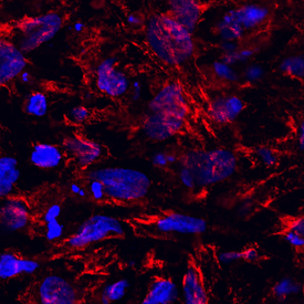Inositol Monophosphatase 3/IMPAD1 in Mouse Mesenchymal Stem Cells. Inositol Monophosphatase 3/IMPAD1 was detected in immersion fixed mouse mesenchymal stem cells differentiated into chondrocytes using Sheep Anti-Mouse/Rat Inositol Monophosphatase 3/IMPAD1 Antigen Affinity-purified Polyclonal Antibody (Catalog # AF7028) at 10 µg/mL for 3 hours at room temperature. Cells were stained using the NorthernLights™ 557-conjugated Anti-Sheep IgG Secondary Antibody (red; Catalog # NL010 ) and counterstained with DAPI (blue). Specific staining was localized to cytoplasm. View our protocol for Fluorescent ICC Staining of Cells on Coverslips .