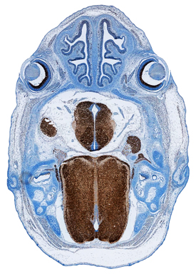SEZ6L2/BSRP-A in Mouse Embryo. SEZ6L2/BSRP-A was detected in immersion fixed frozen sections of mouse embryo (15 d.p.c.) using Sheep Anti-Human/Mouse SEZ6L2/BSRP-A Antigen Affinity-purified Polyclonal Antibody (Catalog # AF4916) at 1.7 µg/mL overnight at 4 °C. Tissue was stained using the Anti-Sheep HRP-DAB Cell & Tissue Staining Kit (brown; Catalog # CTS019 ) and counterstained with hematoxylin (blue). Specific staining was localized to developing brain (medulla oblongata), spinal cord, trigeminal ganglia, and retina. View our protocol for Chromogenic IHC Staining of Frozen Tissue Sections .
