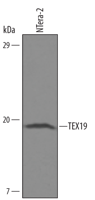 Detection of Human TEX19 by Western Blot. Western blot shows lysates of NTera-2 human testicular embryonic carcinoma cell line. PVDF Membrane was probed with 0.5 µg/mL of Human TEX19 Antigen Affinity-purified Polyclonal Antibody (Catalog # AF6319) followed by HRP-conjugated Anti-Sheep IgG Secondary Antibody (Catalog # HAF016 ). A specific band was detected for TEX19 at approximately 18 kDa (as indicated). This experiment was conducted under reducing conditions and using Immunoblot Buffer Group 8 .