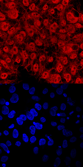 TEX19 in BG01V Human Stem Cells. TEX19 was detected in immersion fixed BG01V human embryonic stem cells using Human TEX19 Antigen Affinity-purified Polyclonal Antibody (Catalog # AF6319) at 10 µg/mL for 3 hours at room temperature. Cells were stained using the NorthernLights™ 557-conjugated Anti-Sheep IgG Secondary Antibody (red, upper panel; Catalog # NL010 ) and counterstained with DAPI (blue, lower panel). Specific staining was localized to nuclei and cytoplasm. View our protocol for Fluorescent ICC Staining of Cells on Coverslips .