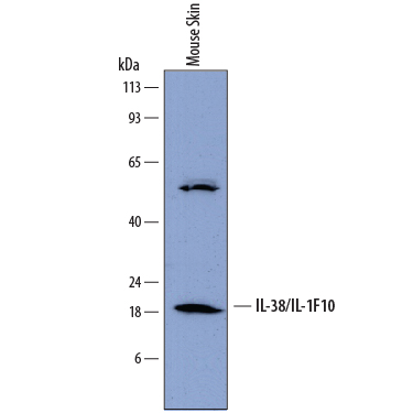 Detection of Mouse IL-38/IL-1F10 by Western Blot. Western blot shows lysates of mouse skin tissue. PVDF membrane was probed with 2 µg/mL of Rat Anti-Mouse IL-38/IL-1F10 Monoclonal Antibody (Catalog # MAB7774) followed by HRP-conjugated Anti-Rat IgG Secondary Antibody (Catalog # HAF005 ). A specific band was detected for IL-38/IL-1F10 at approximately 18 kDa (as indicated). This experiment was conducted under reducing conditions and using Immunoblot Buffer Group 1 .