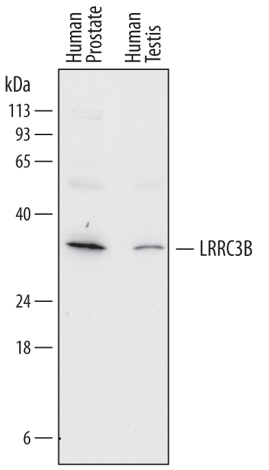 Detection of Human LRRC3B by Western Blot. Western blot shows lysates of human prostate tissue and human testis tissue. PVDF membrane was probed with 2 µg/mL of Mouse Anti-Human LRRC3B Monoclonal Antibody (Catalog # MAB7635) followed by HRP-conjugated Anti-Mouse IgG Secondary Antibody (Catalog # HAF018 ). A specific band was detected for LRRC3B at approximately 33 kDa (as indicated). This experiment was conducted under reducing conditions and using Immunoblot Buffer Group 1 .
