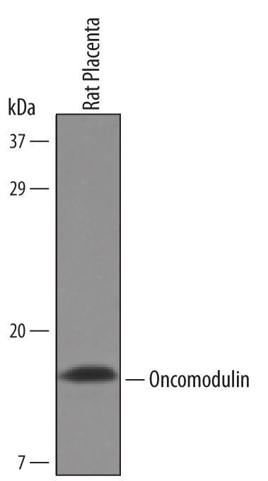 Detection of Rat Oncomodulin by Western Blot. Western blot shows lysates of rat placenta tissue. PVDF Membrane was probed with 1 µg/mL of Rat Oncomodulin Antigen Affinity-purified Polyclonal Antibody (Catalog # AF6345) followed by HRP-conjugated Anti-Goat IgG Secondary Antibody (Catalog # HAF019 ). A specific band was detected for Oncomodulin at approximately 12 kDa (as indicated). This experiment was conducted under reducing conditions and using Immunoblot Buffer Group 8 .