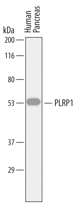 Detection of Human PLRP1 by Western Blot. Western blot shows lysates of human pancreas tissue. PVDF membrane was probed with 1 µg/mL of Sheep Anti-Human PLRP1 Antigen Affinity-purified Polyclonal Antibody (Catalog # AF7105) followed by HRP-conjugated Anti-Sheep IgG Secondary Antibody (Catalog # HAF016 ). A specific band was detected for PLRP1 at approximately 53 kDa (as indicated). This experiment was conducted under reducing conditions and using Immunoblot Buffer Group 1 .