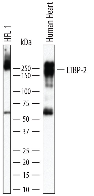 Detection of Human Latent TGF-beta bp2/LTBP-2 by Western Blot. Western blot shows lysates of HFL1 human fetal lung fibroblast cell line and human heart tissue. PVDF membrane was probed with 1 µg/mL of Goat Anti-Human Latent TGF-beta bp2/LTBP-2 Antigen Affinity-purified Polyclonal Antibody (Catalog # AF3850) followed by HRP-conjugated Anti-Goat IgG Secondary Antibody (Catalog # HAF017 ). A specific band was detected for Latent TGF-beta bp2/LTBP-2 at approximately 210-255 kDa (as indicated). This experiment was conducted under reducing conditions and using Immunoblot Buffer Group 1 .