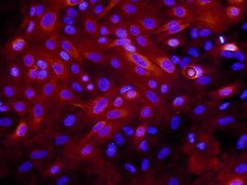 Laminin a3/Laminin-5 in MCF 10A Human Cell Line. Laminin a3/Laminin-5 was detected in immersion fixed MCF 10A human breast epithelial cell line using 10 µg/mL Mouse Anti-Human Laminin a3/Laminin-5 Monoclonal Antibody (Catalog # MAB2144) for 3 hours at room temperature. Cells were stained with the NorthernLights™ 557-conjugated Anti-Mouse IgG Secondary Antibody (red; Catalog # NL007 ) and counterstained with DAPI (blue). View our protocol for Fluorescent ICC Staining of Cells on Coverslips .