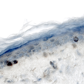 Laminin a3/Laminin-5 in Human Skin. Laminin a3/Laminin-5 was detected in immersion fixed paraffin-embedded sections of human skin using Mouse Anti-Human Laminin a3/Laminin-5 Monoclonal Antibody (Catalog # MAB2144) at 25 µg/mL overnight at 4 °C. Tissue was stained using the Anti-Mouse HRP-DAB Cell & Tissue Staining Kit (brown; Catalog # CTS002 ) and counterstained with hematoxylin (blue). Specific labeling was localized to cell in the epiderimis. View our protocol for Chromogenic IHC Staining of Paraffin-embedded Tissue Sections .