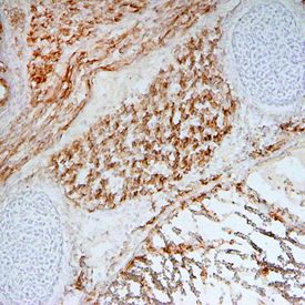 Wnt‑11 in Mouse Embryo. Wnt‑11 was detected in immersion fixed frozen sections of mouse embryo (15 d.p.c.) using Rat Anti-Mouse Wnt‑11 Monoclonal Antibody (Catalog # MAB3746) at 25 µg/mL overnight at 4 °C. Tissue was stained using the Anti-Mouse HRP-DAB Cell & Tissue Staining Kit (brown; Catalog # CTS002) and counterstained with hematoxylin (blue). Specific staining was localized to cytoplasm of muscle cells. View our protocol for Chromogenic IHC Staining of Frozen Tissue Sections.