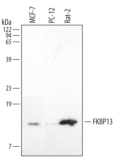 Detection of Human and Rat FKBP13 by Western Blot. Western blot shows lysates of MCF‑7 human breast cancer cell line, PC‑12 rat adrenal pheochromocytoma cell line, and Rat‑2 rat embryonic fibroblast cell line. PVDF membrane was probed with 1 µg/mL of Human/Mouse/Rat FKBP13 Monoclonal Antibody (Catalog # MAB4356) followed by HRP-conjugated Anti-Rat IgG Secondary Antibody (Catalog # HAF005). A specific band was detected for FKBP13 at approximately 13 kDa (as indicated). This experiment was conducted under reducing conditions and using Immunoblot Buffer Group 1.