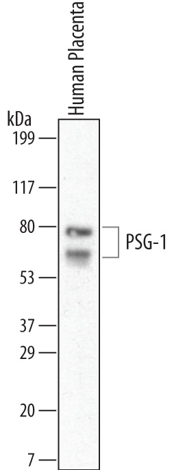 Detection of Human PSG‑1 by Western Blot. Western blot shows lysates of human placenta tissue. PVDF membrane was probed with 1 µg/mL of Mouse Anti-Human PSG‑1 Monoclonal Antibody (Catalog # MAB6799) followed by HRP-conjugated Anti-Mouse IgG Secondary Antibody (Catalog # HAF007). Specific bands were detected for PSG‑1 at approximately 72 and 64 kDa (as indicated). This experiment was conducted under reducing conditions and using Immunoblot Buffer Group 1. 