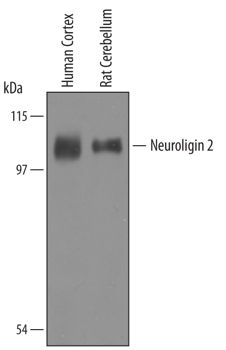 Detection of Human and Rat Neuroligin 2/NLGN2 by Western Blot.Western blot shows lysates of human cortex and rat cerebellum tissue. PVDF membrane was probed with 1 µg/mL of Goat Anti-Human/Rat Neuroligin 2/NLGN2 Antigen Affinity-purified Polyclonal Antibody (Catalog # AF5645) followed by HRP-conjugated Anti-Goat IgG Secondary Antibody (Catalog # HAF019). A specific band was detected for Neuroligin 2/NLGN2 at approximately XXX kDa (as indicated). This experiment was conducted under reducing conditions and using Immunoblot Buffer Group 8.