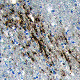 Calsyntenin‑3 in Human Brain. Calsyntenin‑3 was detected in immersion fixed paraffin-embedded sections of human brain (cortex) using Sheep Anti-Human Calsyntenin‑3 Antigen Affinity-purified Polyclonal Antibody (Catalog # AF5244) at 15 µg/mL overnight at 4 °C. Before incubation with the primary antibody tissue was subjected to heat-induced epitope retrieval using Antigen Retrieval Reagent-Basic (Catalog # CTS013). Tissue was stained using the Anti-Sheep HRP-DAB Cell & Tissue Staining Kit (brown; Catalog # CTS019) and counterstained with hematoxylin (blue). Specific labeling was localized to the neuronal processes and synaptic boutons. View our protocol for Chromogenic IHC Staining of Paraffin-embedded Tissue Sections.