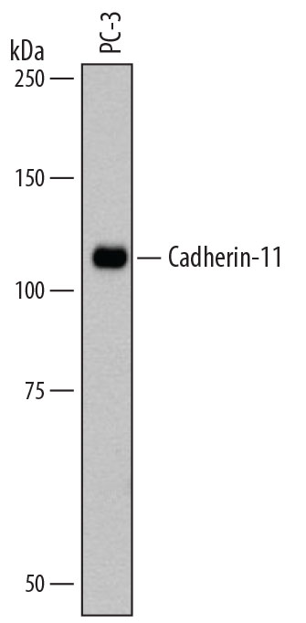 Detection of Human Cadherin‑11 by Western Blot.Western blot shows lysates of PC‑3 human prostate cancer cell line. PVDF membrane was probed with 1 µg/mL of Mouse Anti-Human Cadherin‑11 Monoclonal Antibody (Catalog # MAB1790) followed by HRP-conjugated Anti-Mouse IgG Secondary Antibody (Catalog # HAF007). A specific band was detected for Cadherin‑11 at approximately 110 kDa (as indicated). This experiment was conducted under reducing conditions and using Immunoblot Buffer Group 1.