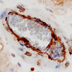 Cadherin‑11 in Human Placenta.Cadherin‑11 was detected in immersion fixed paraffin-embedded sections of human placenta using Mouse Anti-Human Cadherin‑11 Monoclonal Antibody (Catalog # MAB1790) at 8 µg/mL overnight at 4 °C. Tissue was stained using the Anti-Mouse HRP-DAB Cell & Tissue Staining Kit (brown; Catalog # CTS002) and counterstained with hematoxylin (blue). View our protocol for Chromogenic IHC Staining of Paraffin-embedded Tissue Sections.