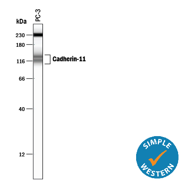 Detection of Human Cadherin‑11 by Simple WesternTM. Simple Western lane view shows lysates of PC‑3 human prostate cancer cell line, loaded at 0.2 mg/mL. Specific bands were detected for Cadherin‑11 at approximately 114 & 137 kDa (as indicated) using 20 µg/mL of Mouse Anti-Human Cadherin‑11 Monoclonal Antibody (Catalog # MAB1790). This experiment was conducted under reducing conditions and using the 12-230 kDa separation system. Non-specific interaction with the 230 kDa Simple Western standard may be seen with this antibody.