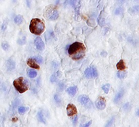 Myeloperoxidase/MPO in Human Spleen. Myeloperoxidase/MPO was detected in immersion fixed paraffin-embedded sections of human spleen using 3 µg/mL Goat Anti-Human/Mouse Myeloperoxidase/MPO Antigen Affinity-purified Polyclonal Antibody (Catalog # AF3667) overnight at 4 °C. Before incubation with the primary antibody tissue was subjected to heat-induced epitope retrieval using Antigen Retrieval Reagent-Basic (Catalog # CTS013). Tissue was stained with the Anti-Goat HRP-DAB Cell & Tissue Staining Kit (brown; Catalog # CTS008) and counterstained with hematoxylin (blue). View our protocol for Chromogenic IHC Staining of Paraffin-embedded Tissue Sections.