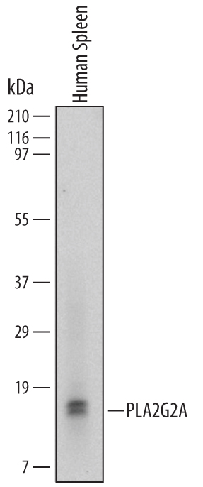 Detection of Human PLA2G2A by Western Blot. Western blot shows lysates of human spleen tissue. PVDF Membrane was probed with 2 µg/mL of Human PLA2G2A Monoclonal Antibody (Catalog # MAB5374) followed by HRP-conjugated Anti-Mouse IgG Secondary Antibody (Catalog # HAF007). A specific band was detected for PLA2G2A at approximately 17 kDa (as indicated). This experiment was conducted under non-reducing conditions and using Immunoblot Buffer Group 1.