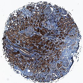 Protocadherin‑15 in Human Kidney. Protocadherin‑15 was detected in immersion fixed paraffin-embedded sections of human kidney using Sheep Anti-Human Protocadherin‑15 Antigen Affinity-purified Polyclonal Antibody (Catalog # AF6729) at 10 µg/mL overnight at 4 °C. Tissue was stained using the Anti-Sheep HRP-DAB Cell & Tissue Staining Kit (brown; Catalog # CTS019 ) and counterstained with hematoxylin (blue). Specific staining was localized to cytoplasm in convoluted tubules. View our protocol for Chromogenic IHC Staining of Paraffin-embedded Tissue Sections .