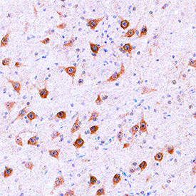 NETO1 in Human Prostate. NETO1 was detected in immersion fixed paraffin-embedded sections of human prostate using Sheep Anti-Human NETO1 Antigen Affinity-purified Polyclonal Antibody (Catalog # AF4337) at 15 µg/mL overnight at 4 °C. Tissue was stained using the Anti-Sheep HRP-DAB Cell & Tissue Staining Kit (brown; Catalog # CTS019 ) and counterstained with hematoxylin (blue). Specific staining was localized to neuronal cell bodies. View our protocol for Chromogenic IHC Staining of Paraffin-embedded Tissue Sections .