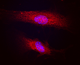 Polycystin‑1/PKD1 in Human HUVEC. Polycystin‑1/PKD1 was detected in immersion fixed HUVEC human umbilical vein endothelial cells using Sheep Anti-Human Polycystin‑1/PKD1 Antigen Affinity-purified Polyclonal Antibody (Catalog # AF6270) at 10 µg/mL for 3 hours at room temperature. Cells were stained using the NorthernLights™ 557-conjugated Anti-Sheep IgG Secondary Antibody (red; Catalog # NL010 ) and counterstained with DAPI (blue). Specific staining was localized to cell membranes, cytoplasm and endoplasmic reticula. View our protocol for Fluorescent ICC Staining of Cells on Coverslips .