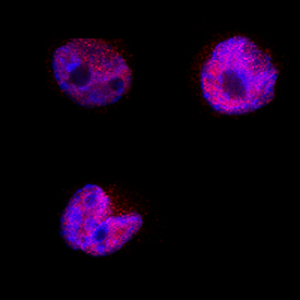 BATF3 in HDLM‑2 Human Cell Line. BATF3 was detected in immersion fixed HDLM‑2 human Hodgkin's lymphoma cell line using Sheep Anti-Human BATF3 Antigen Affinity-purified Polyclonal Antibody (Catalog # AF7437) at 5 µg/mL for 3 hours at room temperature. Cells were stained using the NorthernLights™ 557-conjugated Anti-Sheep IgG Secondary Antibody (red; Catalog # NL010 ) and counterstained with DAPI (blue). Specific staining was localized to cytoplasm and nuclei. View our protocol for Fluorescent ICC Staining of Non-adherent Cells .