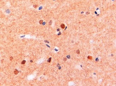 Anti-CD11b antibody, Internal used in IHC (Formalin-fixed paraffin-embedded sections). GTX89035