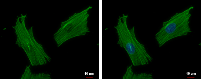 Anti-ACTR1B antibody used in ICC/IF. GTX115347