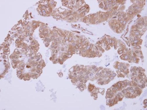 Anti-ACTR1B antibody used in IHC (Formalin-fixed paraffin-embedded sections). GTX115347