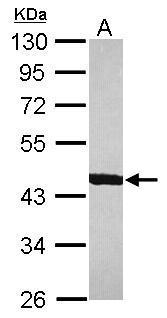 Anti-ACTR1B antibody used in Western blot. GTX115347