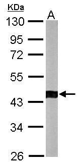 Anti-ACTR1B antibody used in Western blot. GTX115347