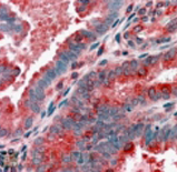 Anti-ACTR1B antibody used in IHC (Formalin-fixed paraffin-embedded sections). GTX13802