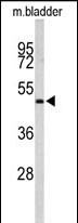 Anti-ACTR3B antibody, C-term used in Western blot. GTX81186