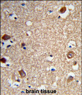Anti-ACTR5 antibody, C-term used in IHC (Formalin-fixed paraffin-embedded sections). GTX80453