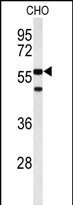 Anti-ACTR5 antibody, C-term used in Western blot. GTX80453