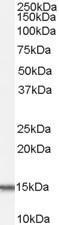 Anti-ACYP1 (isoform a) antibody, Internal used in Western blot. GTX89173