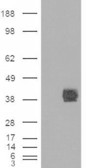 Anti-CD32B antibody, C-term used in Western blot. GTX89542