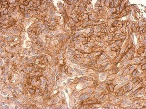 Anti-ADAMTSL2 antibody [C3], C-term used in IHC (Formalin-fixed paraffin-embedded sections). GTX102069