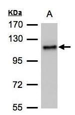 Anti-ADAMTSL2 antibody [C3], C-term used in Western blot. GTX102069