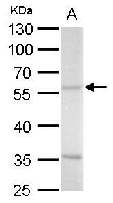 Anti-ADC antibody [N2C2], Internal used in Western blot. GTX120705