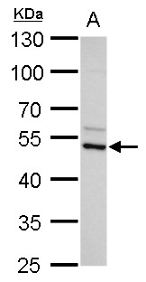 Anti-ADC antibody [N2C2], Internal used in Western blot. GTX120705