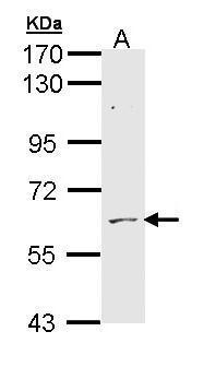 Anti-ADCK1 antibody [N1N3] used in Western blot. GTX111437