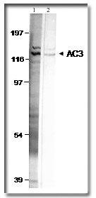 Anti-ADCY3 antibody used in Western blot. GTX14778