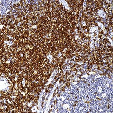 Anti-CD43 T cell antibody [DF-T1] (ready-to-use) used in IHC (Formalin-fixed paraffin-embedded sections). GTX73451