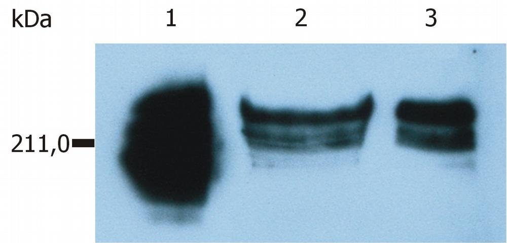 Anti-CD45RA antibody [MEM-56] (Biotin) used in Western blot. GTX78297