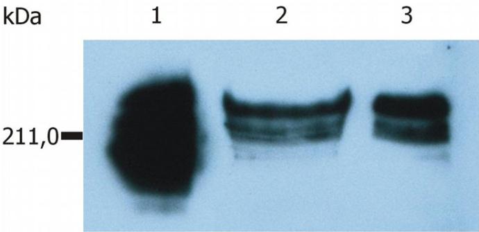 Anti-CD45RA antibody [MEM-56] (FITC) used in Western blot. GTX18240