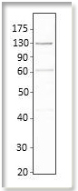 Anti-Adenylate cyclase 6 antibody used in Western blot. GTX47798